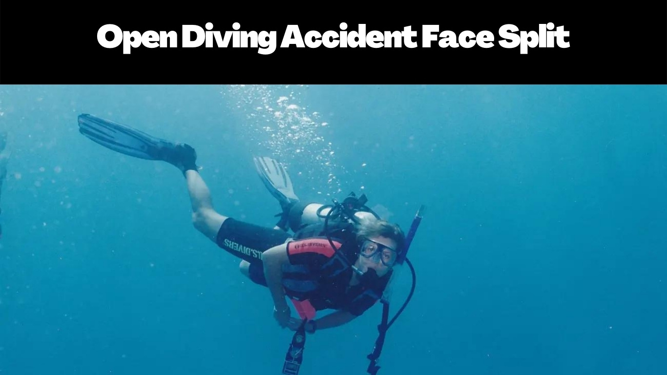 Open Diving Accident Face Split