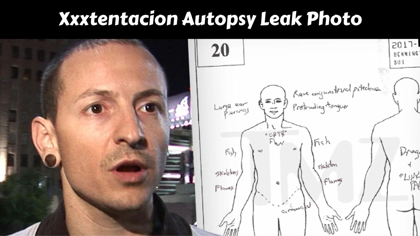 Xxxtentacion Autopsy Leak Photo