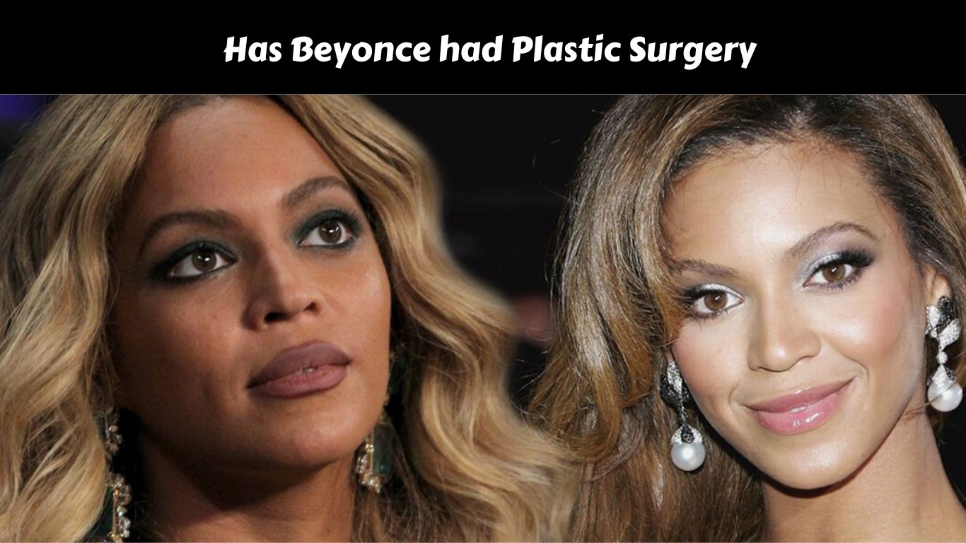 Has Beyonce had Plastic Surgery