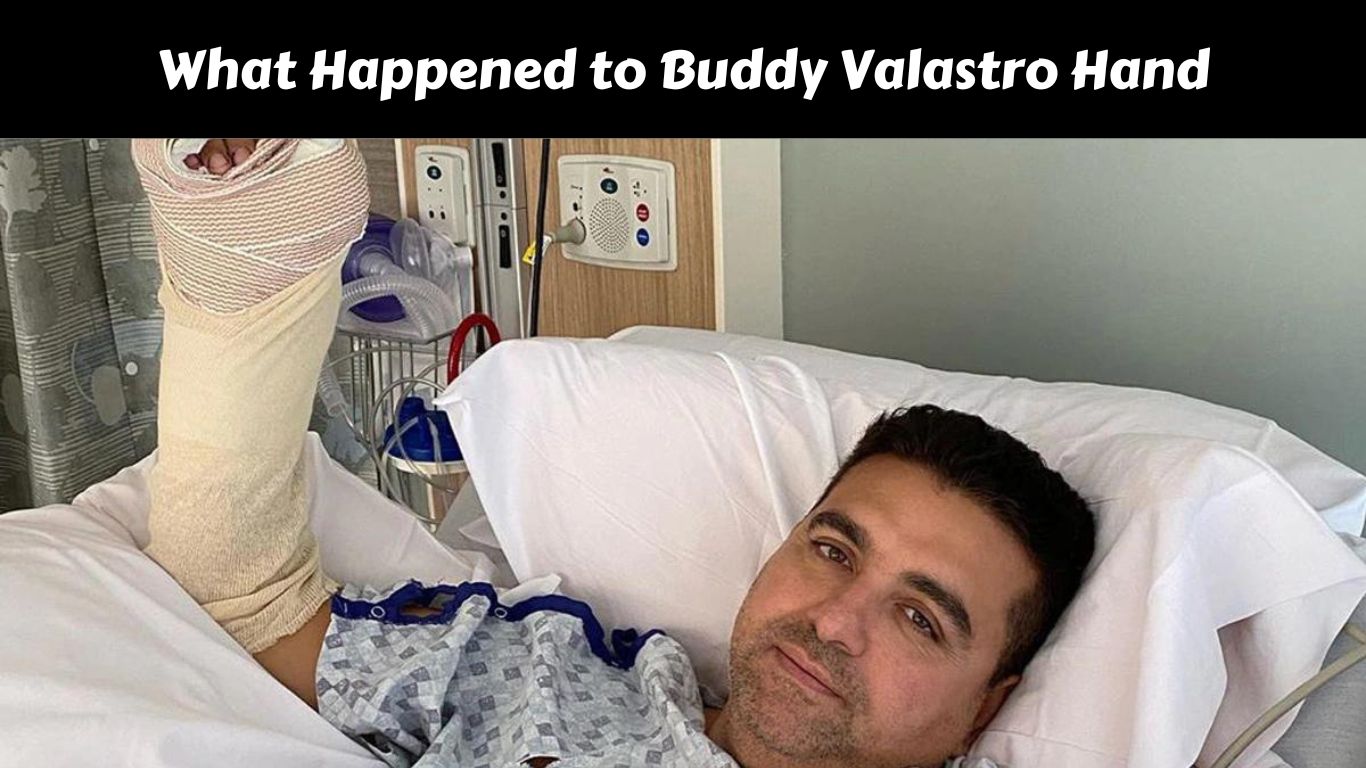 What Happened to Buddy Valastro Hand