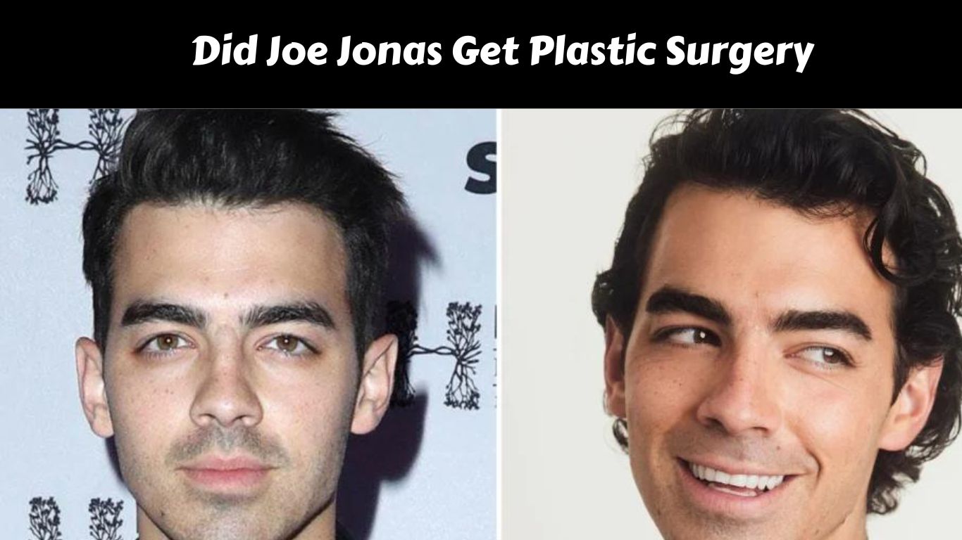 Did Joe Jonas Get Plastic Surgery